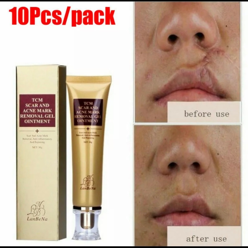 TCM SCAR AND ACNE MARK REMOVAL , Anti-inflammatory